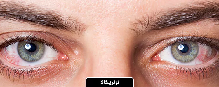 مکمل Ocuvite 50+ Eye Vitamin Mineral از برند Ocuvite
