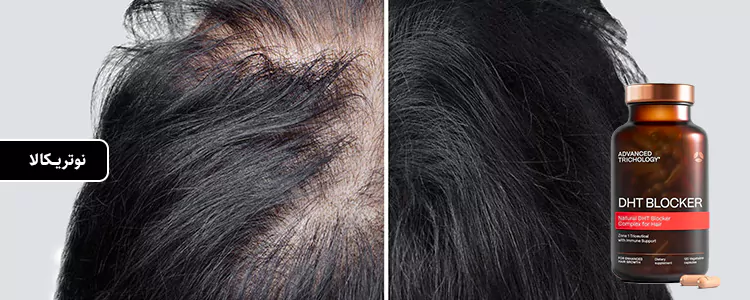مکمل DHT Blocker از برند Advanced Trichology